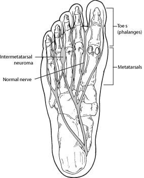 bone in ball of foot